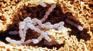 Streptococcus salivarius
