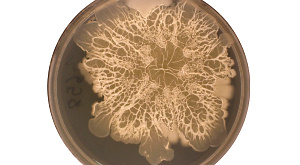 колония бактерий из пупка в чашке Петри