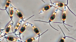 Pestalotiopsis 