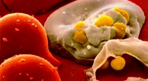 ВИЧ-инфицированные клетки