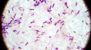 Clostridium perfringens