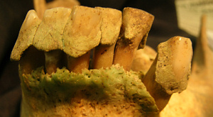 образцы зубов и зубного камня, ставшие предметом исследования 