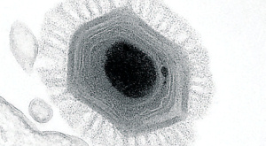 Megavirus chilensis