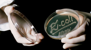 Escherichia coli в чашке Петри