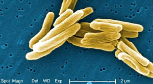 Mycobacterium tuberculosis