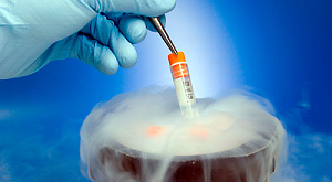 заморозка при помощи жидкого азота в банке спермы