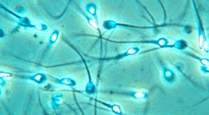 Из клеток кожи получены предшественники сперматозоидов