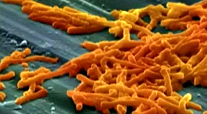 клостридии C.difficile