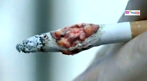 кадр из рекламного ролика с больной раком сигаретой